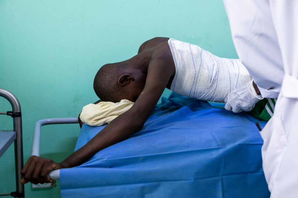 Hissen Ibrahim Abdelmadjid, 15, was treated at a hospital in Tine, Chad, after being caught in a drone attack across the border in Sudan — Joris Bolomey / AFP