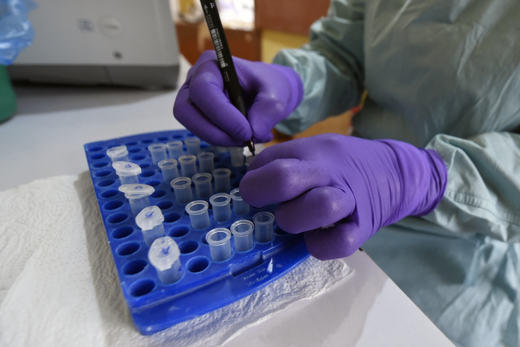 Nigeria Ebola case matches DR Congo strain
