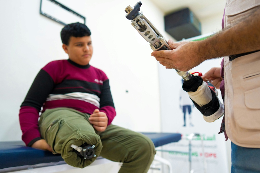 "I took a look at the injured people around me in the hospital. They all had amputated arms and legs, so I told myself: my injury is better" — George SAIF / AFP