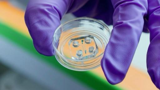 Cancer du sein: l'Institut Curie explore les tumeurs sur puce